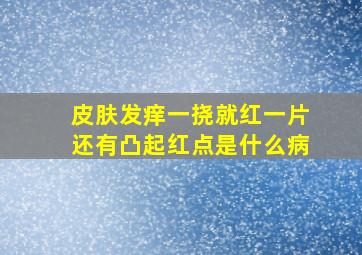 皮肤发痒一挠就红一片还有凸起红点是什么病