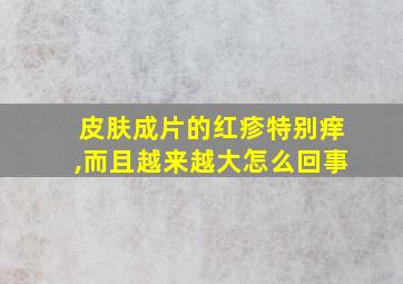 皮肤成片的红疹特别痒,而且越来越大怎么回事