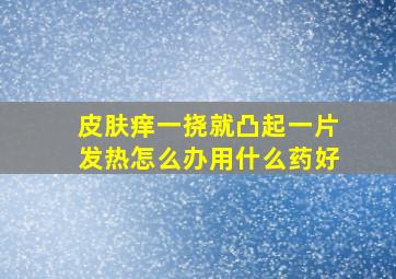 皮肤痒一挠就凸起一片发热怎么办用什么药好