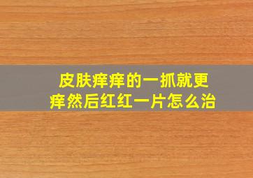 皮肤痒痒的一抓就更痒然后红红一片怎么治