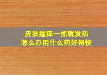 皮肤瘙痒一抓就发热怎么办用什么药好得快