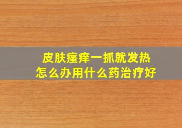 皮肤瘙痒一抓就发热怎么办用什么药治疗好