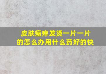 皮肤瘙痒发烫一片一片的怎么办用什么药好的快