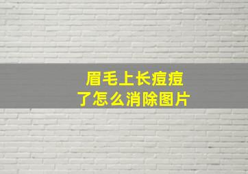 眉毛上长痘痘了怎么消除图片