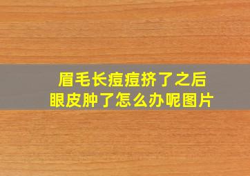 眉毛长痘痘挤了之后眼皮肿了怎么办呢图片