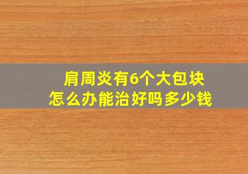 肩周炎有6个大包块怎么办能治好吗多少钱