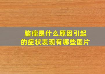 脑瘤是什么原因引起的症状表现有哪些图片