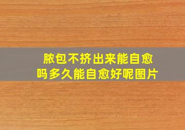 脓包不挤出来能自愈吗多久能自愈好呢图片