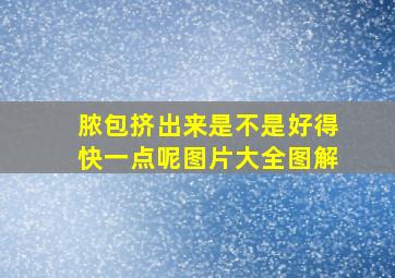 脓包挤出来是不是好得快一点呢图片大全图解