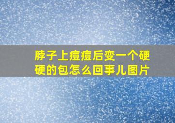 脖子上痘痘后变一个硬硬的包怎么回事儿图片