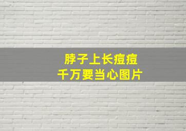 脖子上长痘痘千万要当心图片