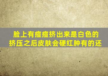 脸上有痘痘挤出来是白色的挤压之后皮肤会硬红肿有的还