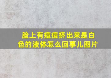 脸上有痘痘挤出来是白色的液体怎么回事儿图片