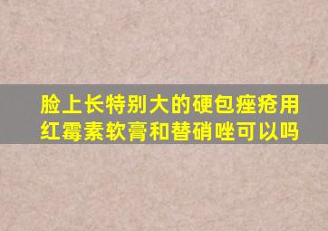 脸上长特别大的硬包痤疮用红霉素软膏和替硝唑可以吗