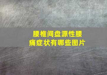 腰椎间盘源性腰痛症状有哪些图片