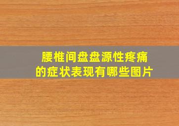 腰椎间盘盘源性疼痛的症状表现有哪些图片