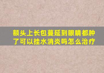 额头上长包蔓延到眼睛都肿了可以挂水消炎吗怎么治疗