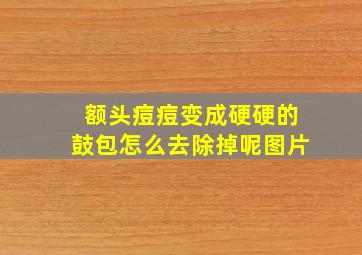 额头痘痘变成硬硬的鼓包怎么去除掉呢图片