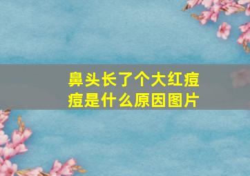 鼻头长了个大红痘痘是什么原因图片