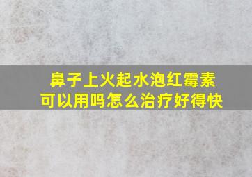 鼻子上火起水泡红霉素可以用吗怎么治疗好得快