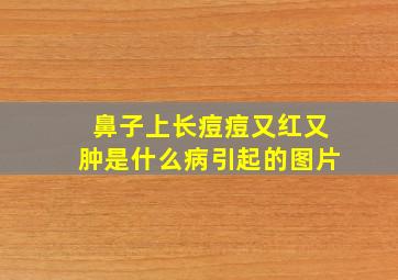 鼻子上长痘痘又红又肿是什么病引起的图片