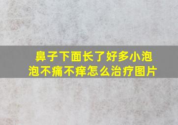 鼻子下面长了好多小泡泡不痛不痒怎么治疗图片