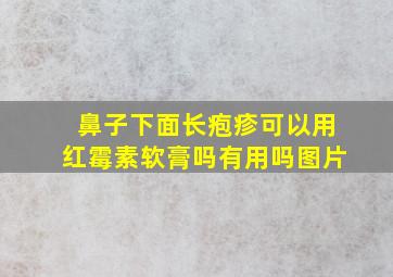 鼻子下面长疱疹可以用红霉素软膏吗有用吗图片