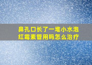 鼻孔口长了一堆小水泡红霉素管用吗怎么治疗